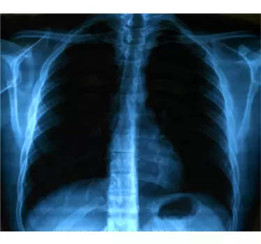 X-ray chest print t-shirt - TenStickers